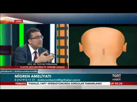 Migren Ameliyatı, Doç. Dr Tayfun Türkaslan, Tgrt Haber - Doktorum Benim